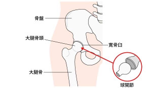 変形性３