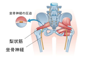 股関節２