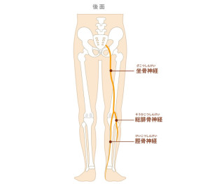 坐骨捻挫３