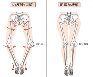 O脚２